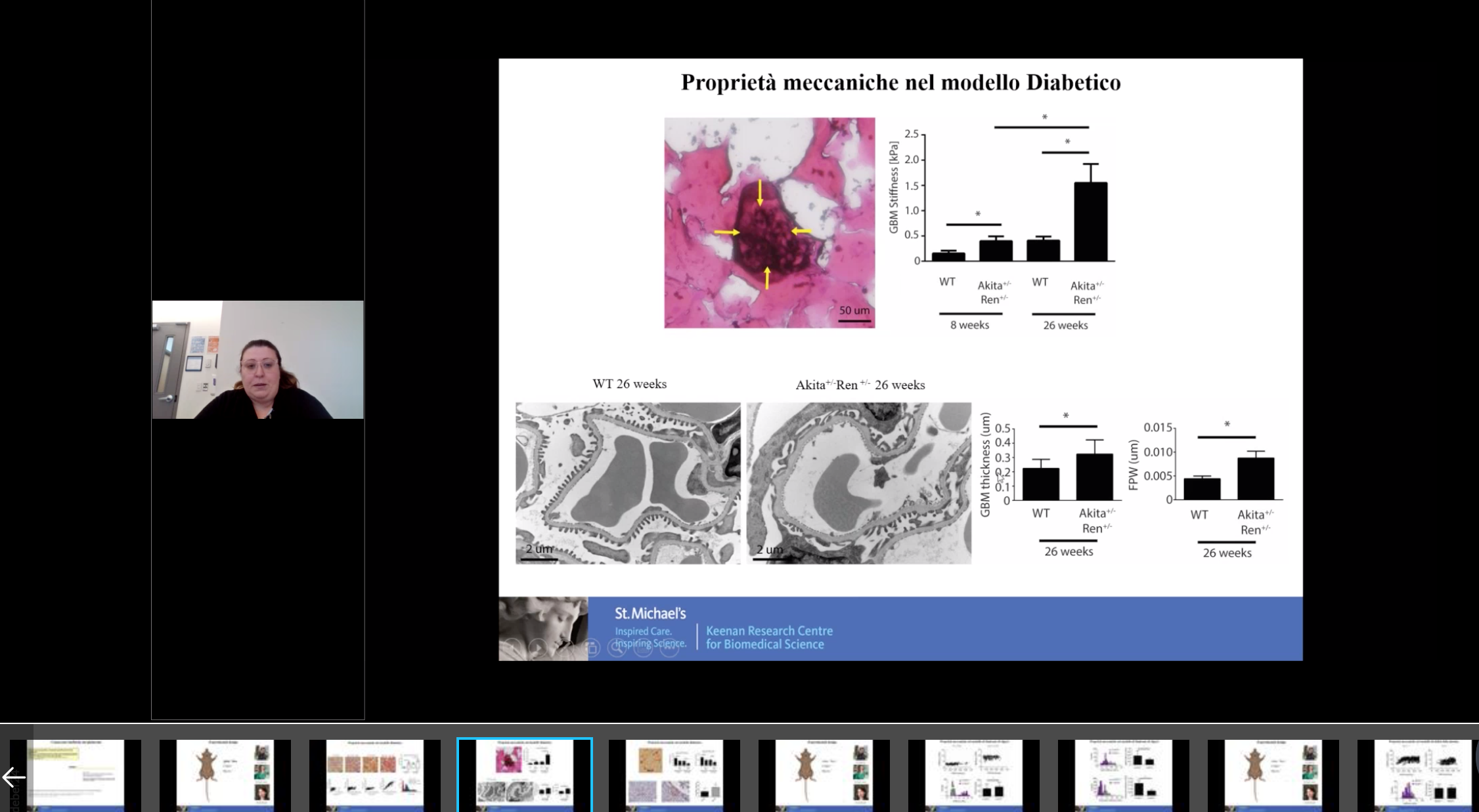La proteinuria: nuovi meccanismi per spiegarne le cause